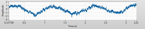 Expanded signal from the top of the weight